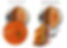 UK Dry Age-Related Macular Degeneration (AMD)