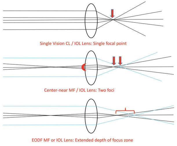 EDOF MECHANISM