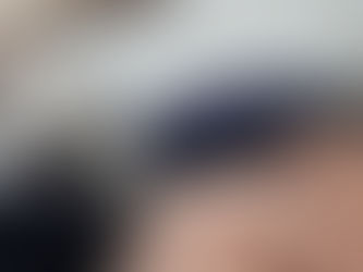 Hydro Peel Facial at Icon Aesthetics: The Deep-Cleaning Treatment for a Clear, Radiant Complexion