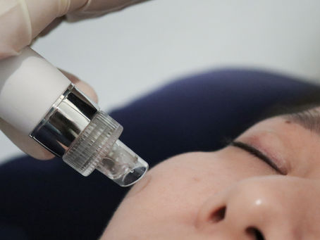 Hydro Peel Facial at Icon Aesthetics: The Deep-Cleaning Treatment for a Clear, Radiant Complexion