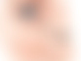 Top 5 Clinics for Undereye Fillers in Singapore (2026 Guide)