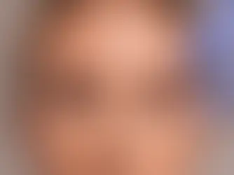 Blefaroplastía: