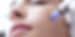 needling.jpg