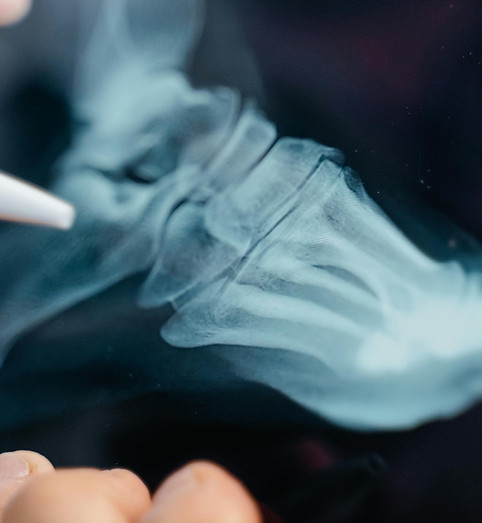 online foot consultation Xray