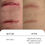 Thumbnail: Tissue Repair