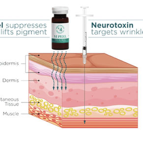 How to Get That Fresh, Filter-Free Fall Glow with VI Peel + Botox in 7 Days Flat