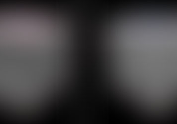 Advanced 3D imaging for deadly lung disease