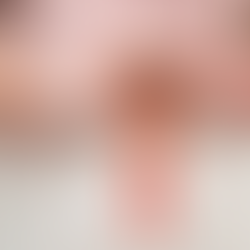 TVS Scan: Scan Lebih Detail, Diagnosis Lebih Tepat