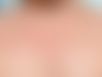 Kızamıkçık / Rubella Enfeksiyonu