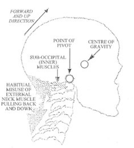 head posture