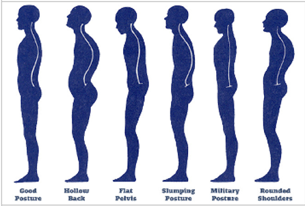 fixing Forward head posture