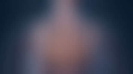 Bone-on-Bone, Bulging Discs, and Arthritis