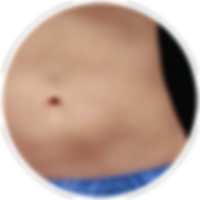 fat-freezing-treatment-area.png