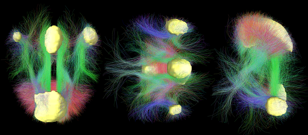 Un esprit qui s'égare est un esprit malheureux - ou pourquoi méditer?