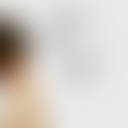 療育を嫌がる子どもへの対応