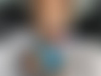 Spud, the Noseless Wonder 🐾