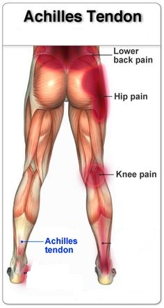 achilles tendinopathy