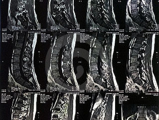 An MRI will reassure me...