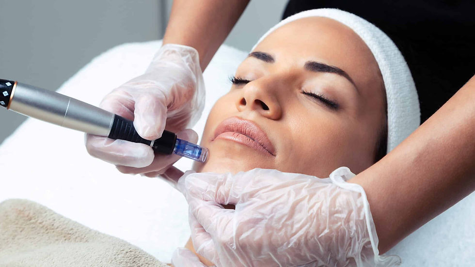 microneedling-nadelen-scaled.jpg