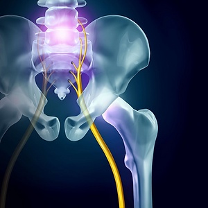 sciatica-nerve-hip-low-back