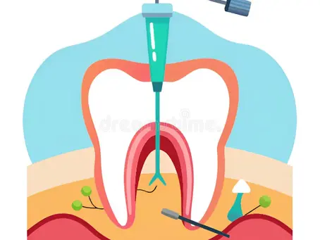 Root Canal Treatment: Myths, Benefits & What to Expect