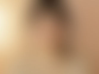 Korean Lateral Canthoplasty in 2026: Candidacy, Technique, and Recovery