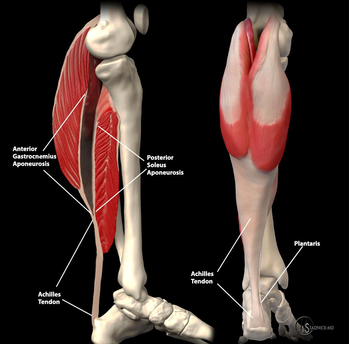Anatomical illustration of the Achilles tendon and surrounding musculature.