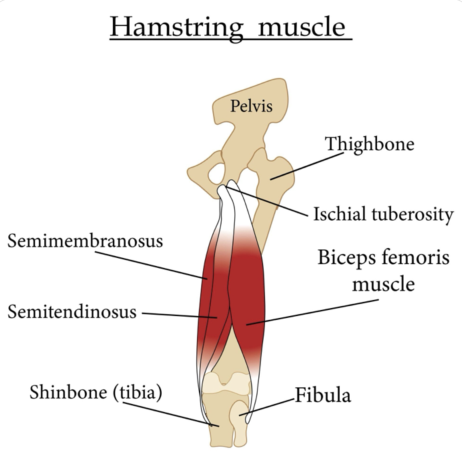 Diagram of the posterior thigh demonstrating the hamstring muscle group, including semimembranosus, semitendinosus, and biceps femoris, originating at the ischial tuberosity and inserting along the tibia and fibula.