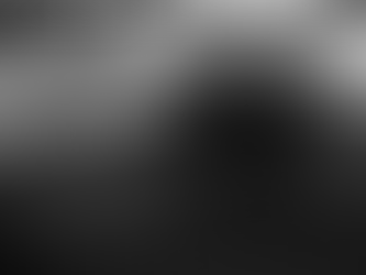 Ultrasound image showing cortical irregularity and periosteal reaction consistent with a stress fracture in the foot.