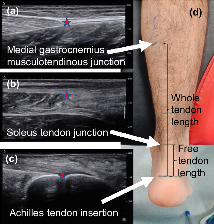 Composite musculoskeletal ultrasound images demonstrating the medial gastrocnemius myotendinous junction, soleus tendon junction, and Achilles tendon insertion, alongside a surface anatomy reference illustrating whole tendon and free tendon length for systematic scanning.