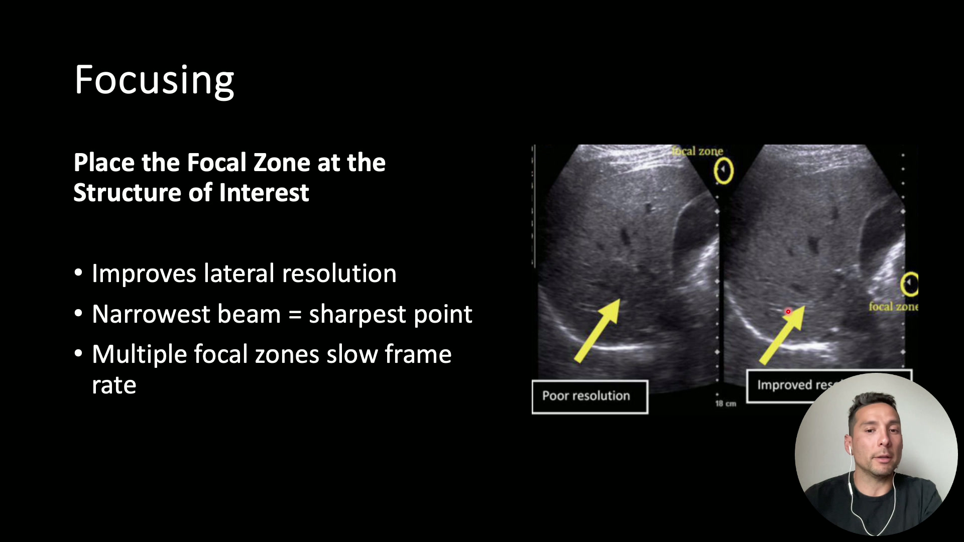 Still from Ultrasound Physics Foundations & Safety
