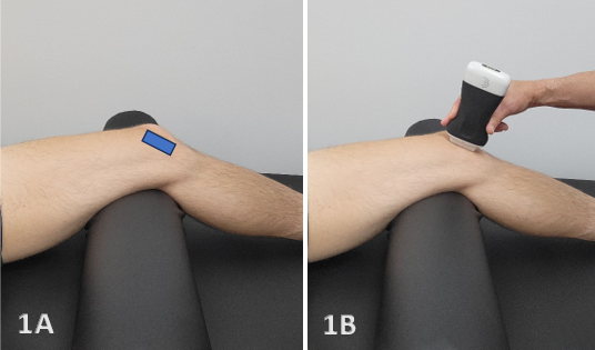 Patient positioning and probe placement for knee ultrasound examination (rectus femoris view).

