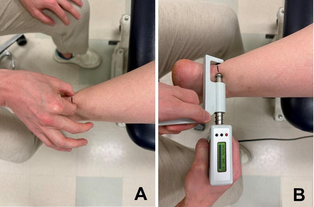 Clinician palpating the Achilles tendon during musculoskeletal examination.
