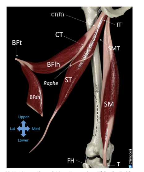 Different parts of hamstring muscles and tendon section as well.