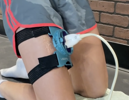 Ultrasound probe secured to the anterior thigh using a ProbeFix device while an athlete performs a Reverse Nordic exercise to allow dynamic ultrasound imaging of the rectus femoris muscle.