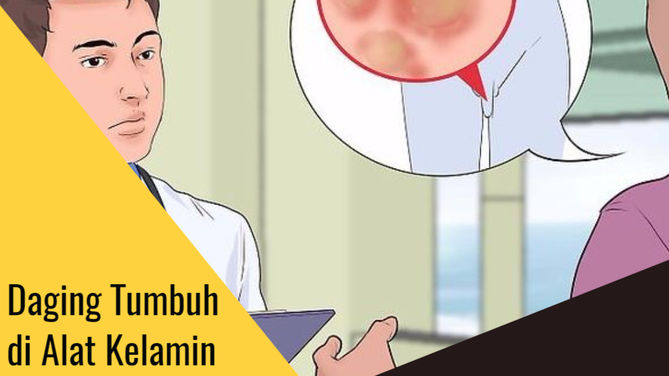 Obat Kutil Kelamin De Nature Paket 2