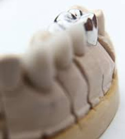 dental bridge.jpeg