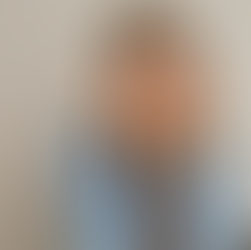 Rinoplastia Estruturada