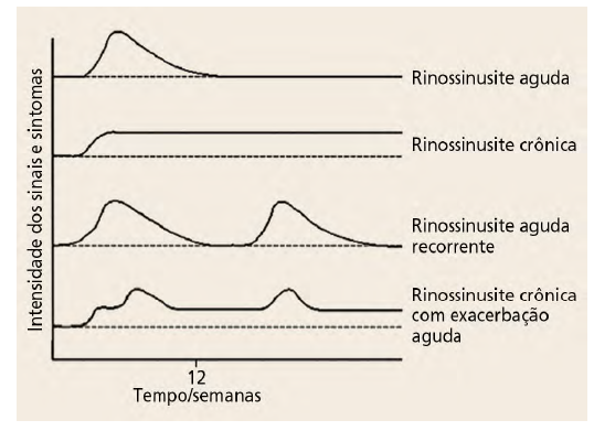Classificação temporal das rinossinusites