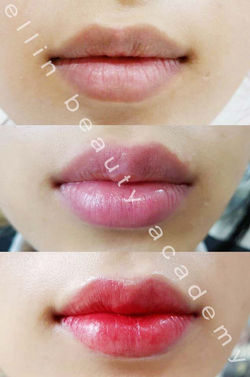 풀커버립 1차 2차