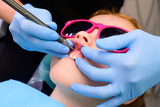 Image of frenectomy in progress