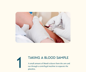 Step 1 in Face PRP: Taking a blood sample