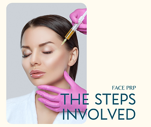 The Steps involved in Face PRP