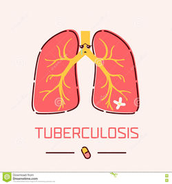 cartel-de-los-pulmones-de-la-tuberculosi