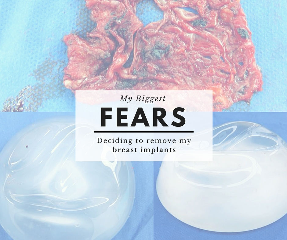 My Biggest Fears - Deciding to remove my breast implants
