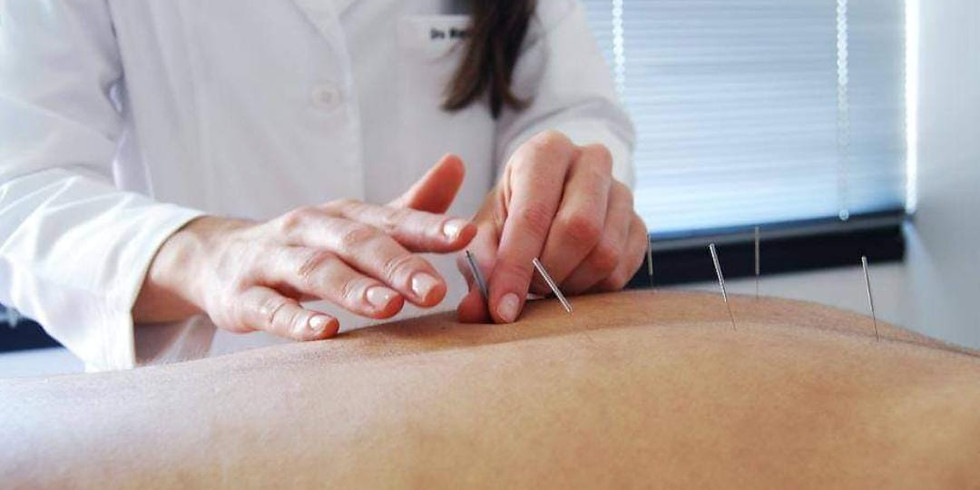 Curso Introdução à Acupuntura