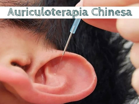 Auriculoterapia e Trabalho de Parto