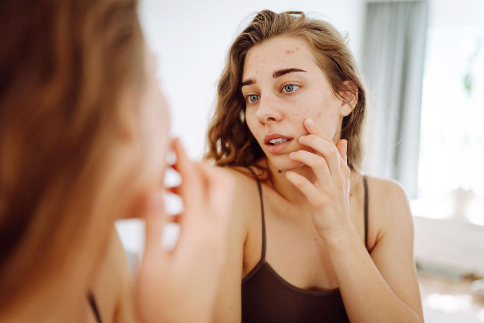 signs of stressed skin redness breakouts dull skin holistic wellness Moses Lake