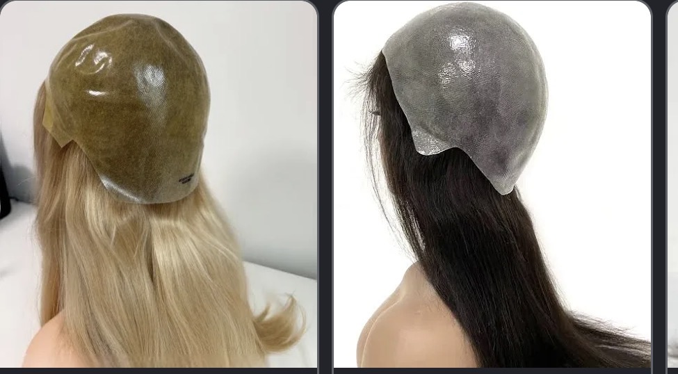 Examples of cranial prosthesis hair replacement systems