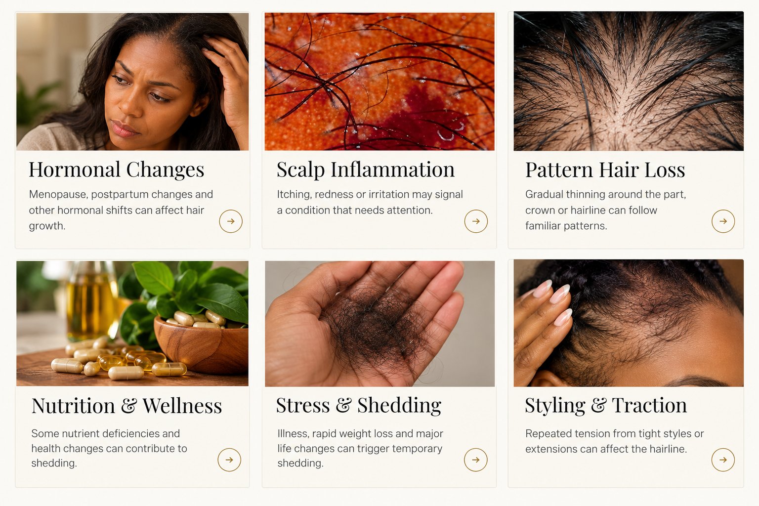 Six hair loss concerns illustrated: hormonal changes, scalp inflammation, pattern hair loss, nutrition and wellness, stress and shedding, and traction